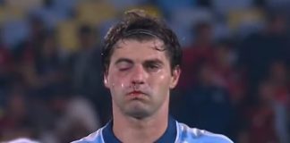 Sosa do Racing com o rosto machucado após choque com companheiro na derrota para o Flamengo