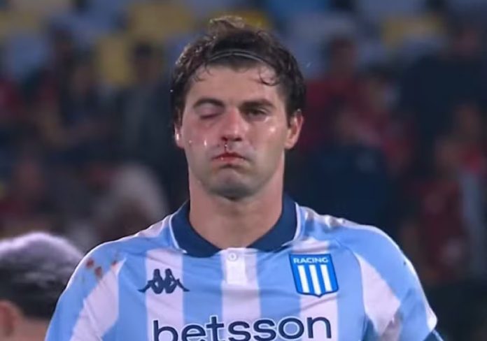 Sosa do Racing com o rosto machucado após choque com companheiro na derrota para o Flamengo