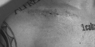 Arrascaeta mostra cicatriz após cirurgia na clavícula